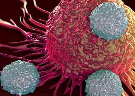 NSCLC: پیشرفت در درمان