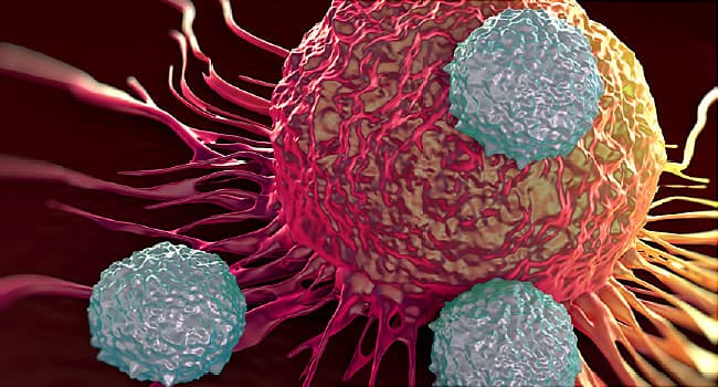 NSCLC: پیشرفت در درمان