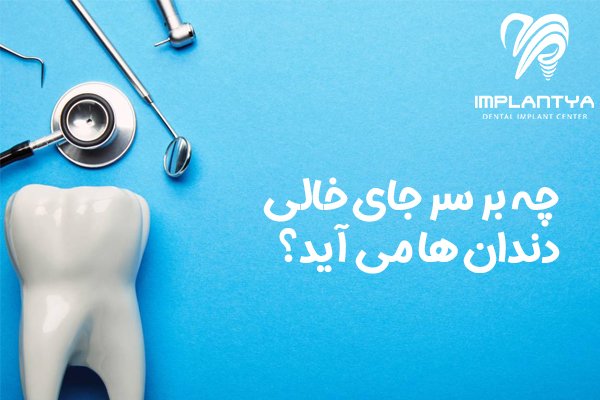 چه بر سر جای خالی دندان ها می آید؟