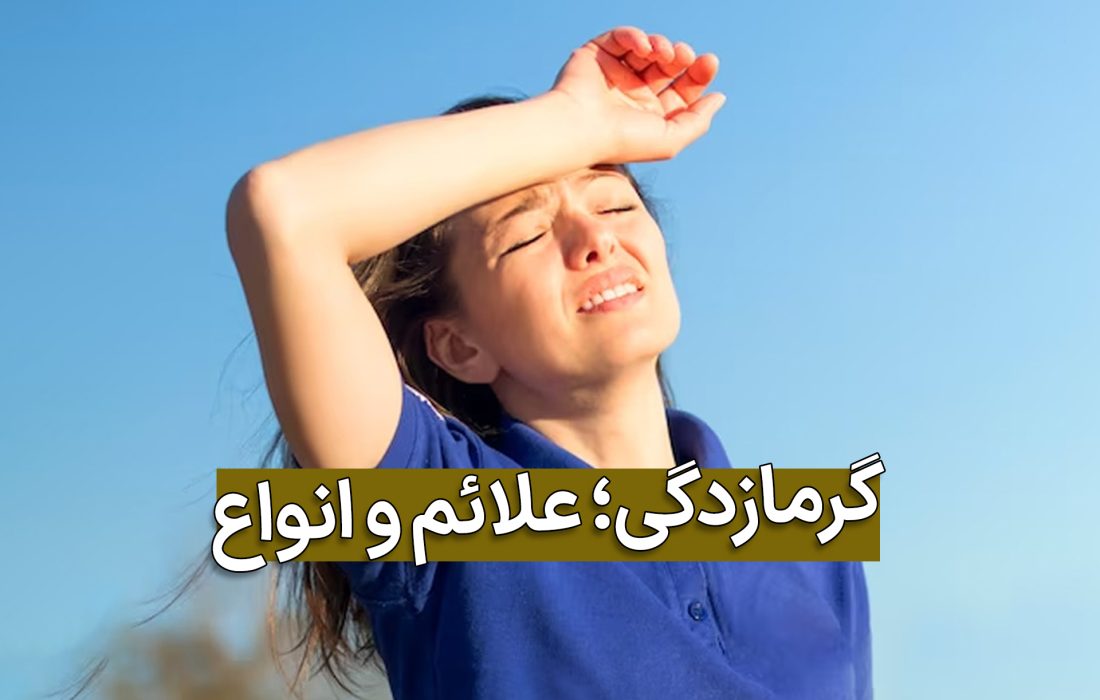 گرمازدگی و روش های درمان آن در خانه