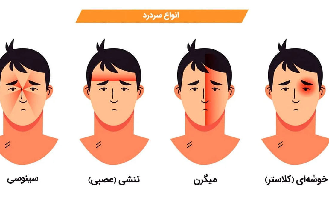 راهنمای کامل برای غلبه بر سردردهای عصبی