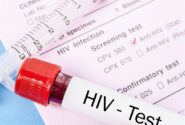 تست ایدز رایگان است/ HIV درمان می شود؟